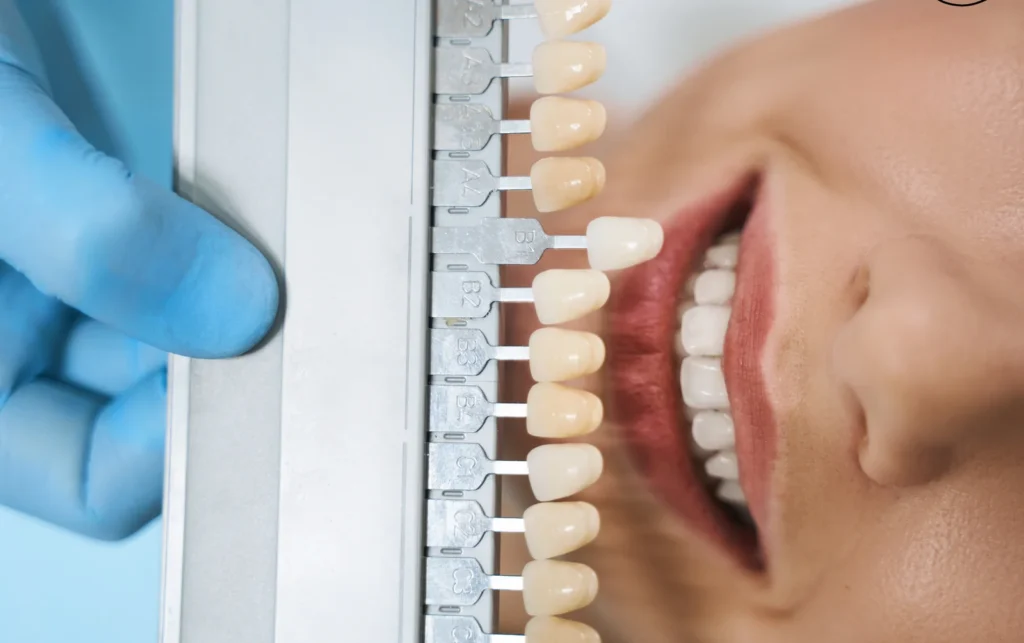 Dentist matching a veneer shade to a patient's teeth at Dorri's Dental in Boynton Beach, FL