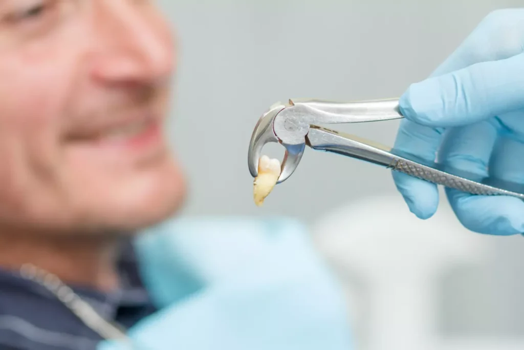 Dentist holding forceps with an extracted tooth at Dorri's Dental in Boynton Beach, FL