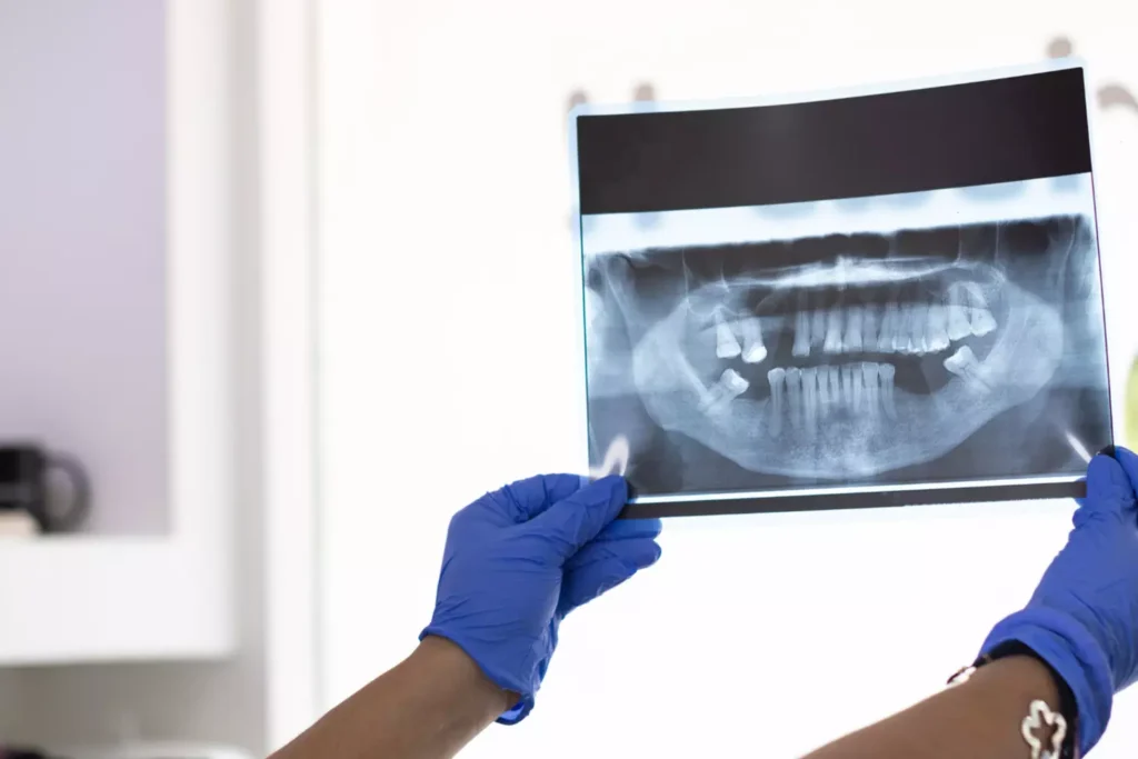 Dentist reviewing full mouth X-ray during comprehensive dental exam and X-rays at Dorri's Dental, Boynton Beach FL