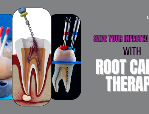 Root Canal in Boynton Beach, FL