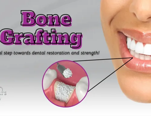 Bone grafting in Boynton Beach, FL