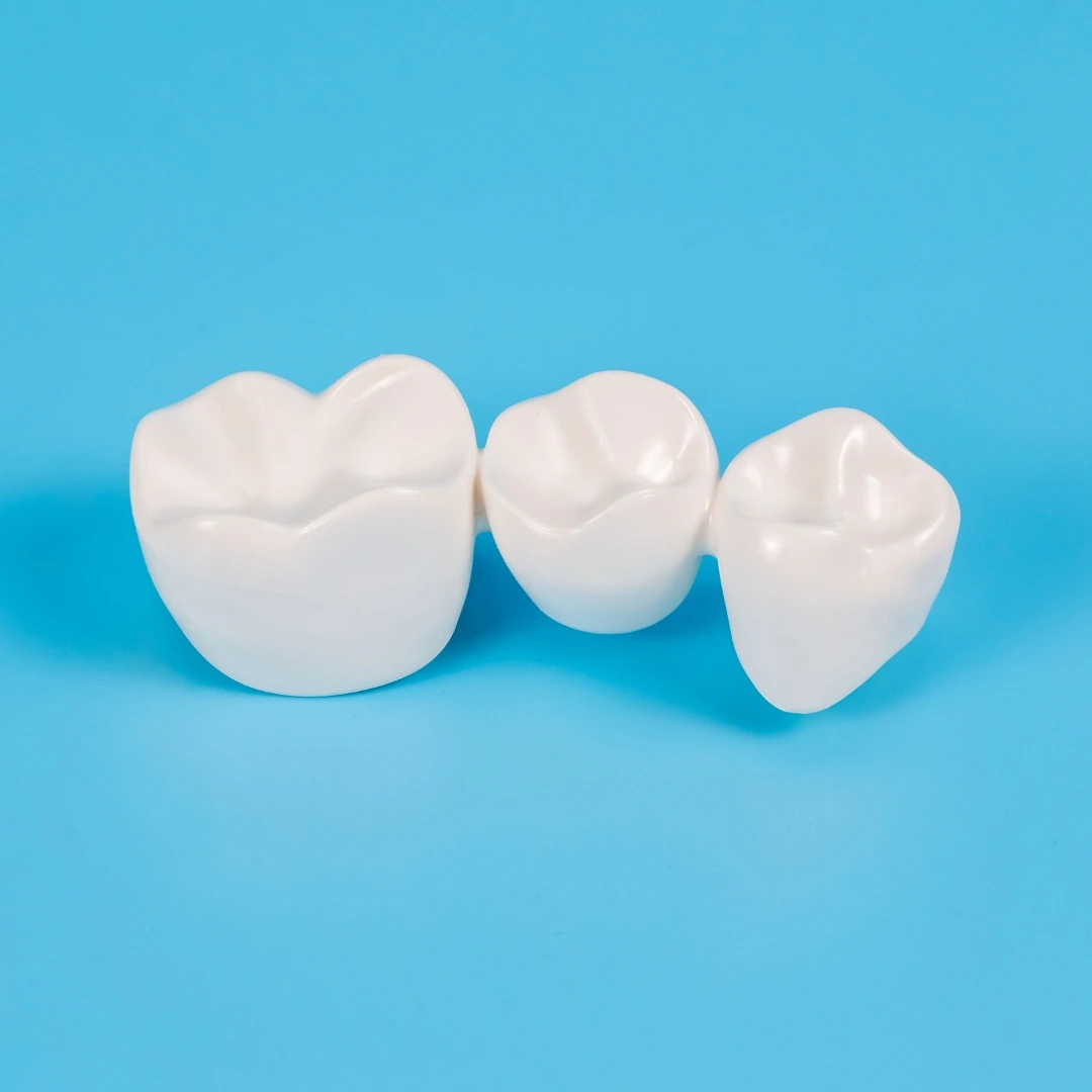 Dental bridges replacing missing teeth in Boynton Beach FL