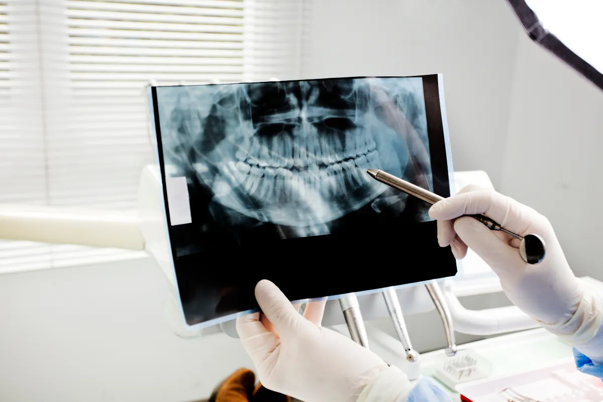 Dental X-Ray