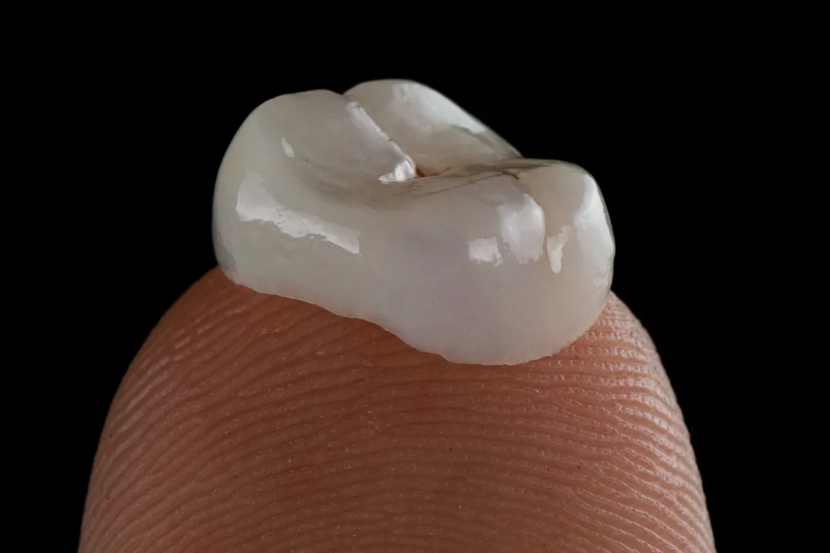 Comparison of different types of dental crowns