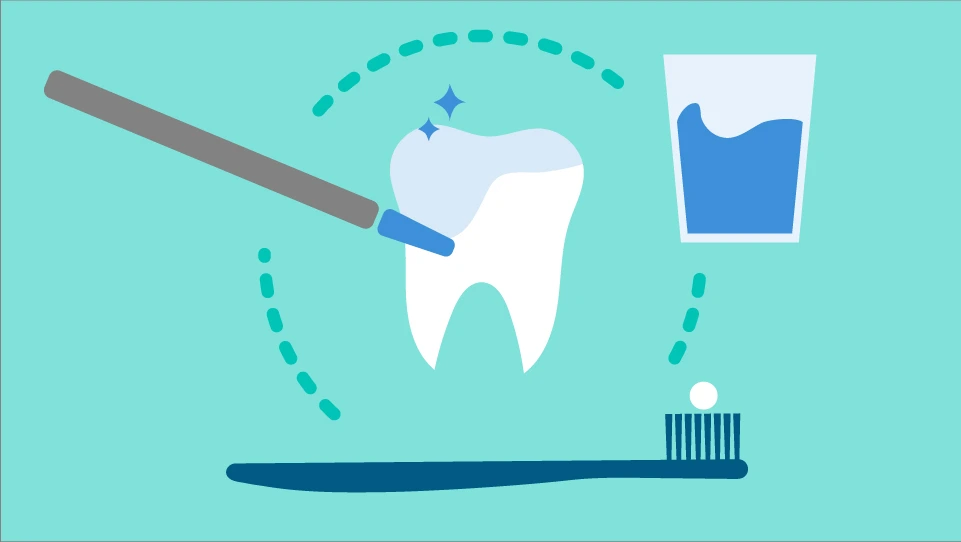 Illustration of a tooth receiving professional fluoride treatment at Dorri's Dental in Boynton Beach, FL