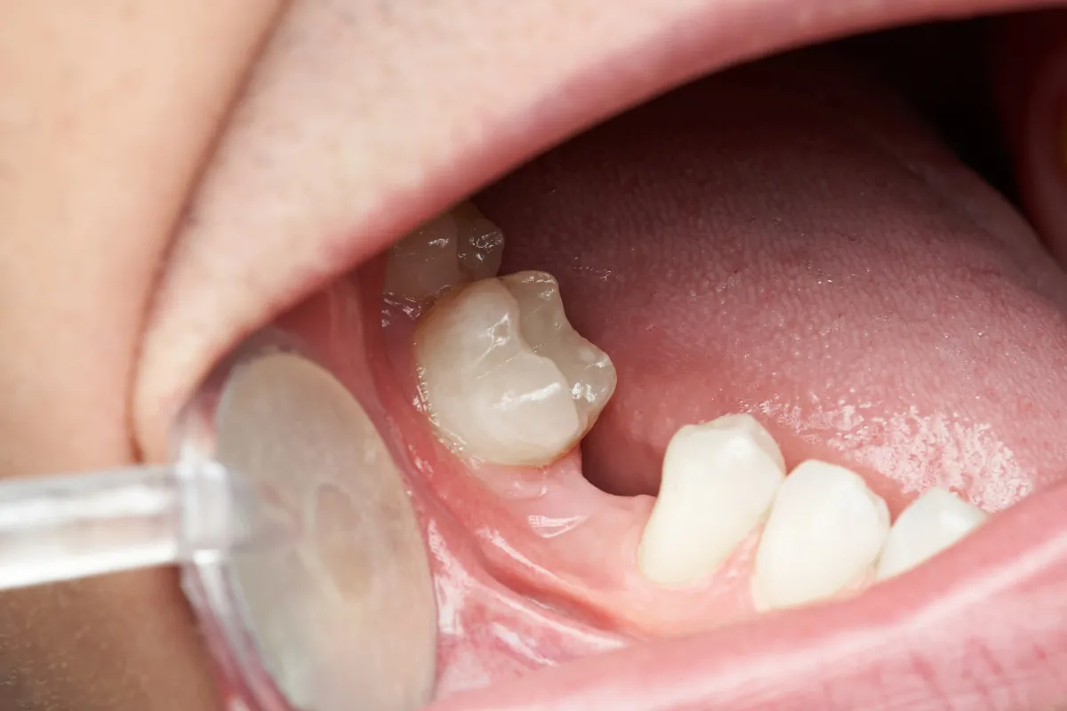 Dental Team Examination
