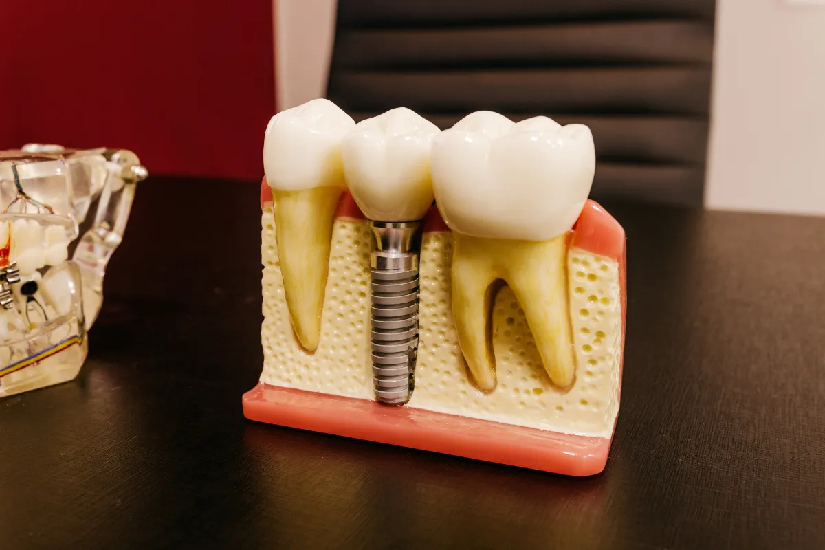 All-on-4 Dental Implants: Are They Right for You in Boynton Beach? 2 Doctor consulting with a patient about All-on-4 dental implants