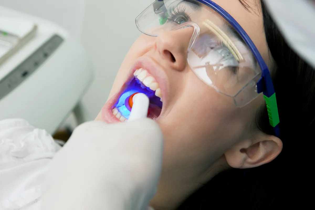 Child with healthy teeth after sealant application