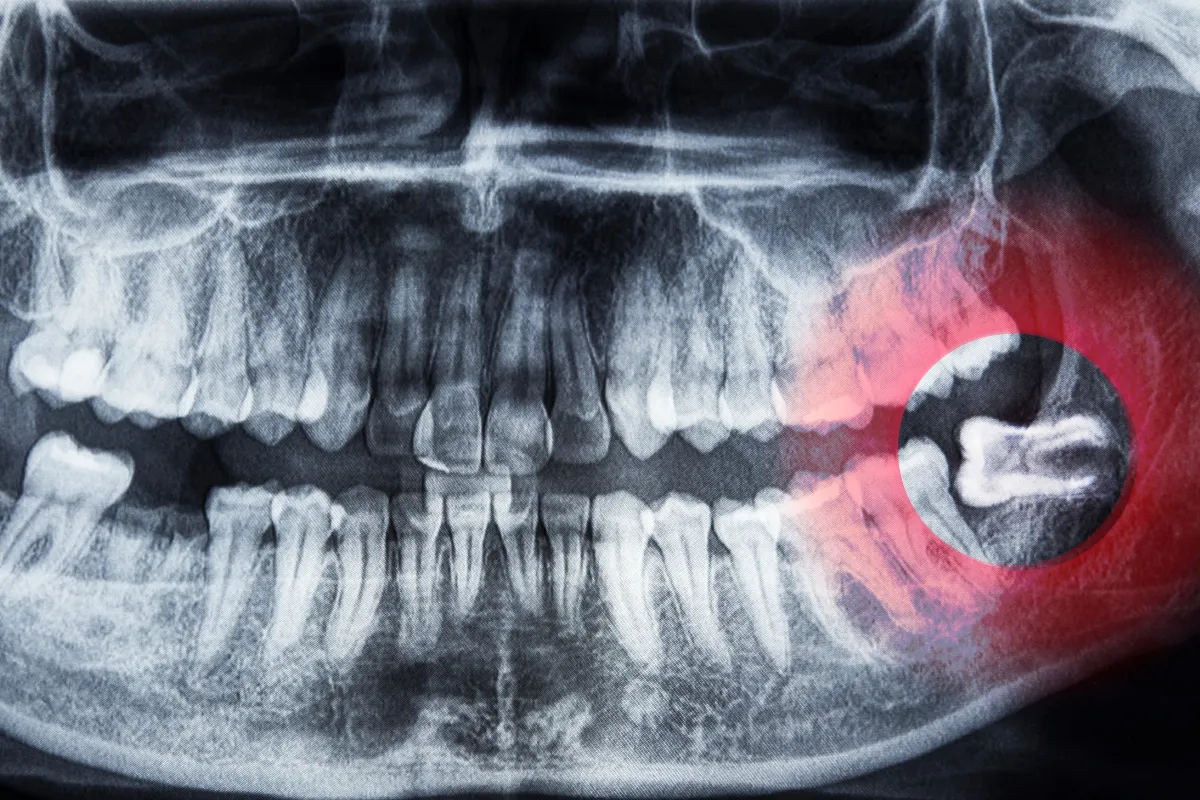 Dentist explaining procedure to patient