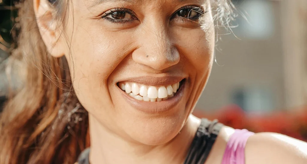 Snap-On Dentures in Boynton Beach: Secure & Comfortable Fit 2 woman smiling with snap-on dentures showing natural-looking teeth